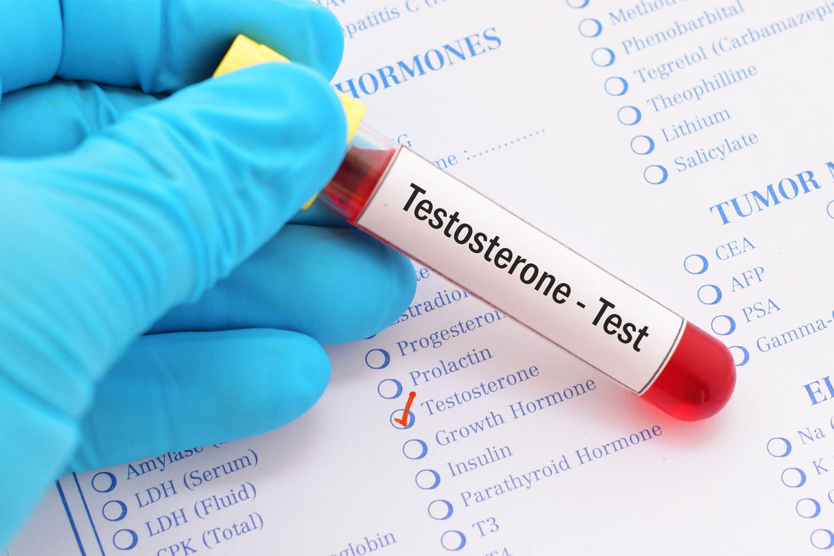 Testosterone Test Testing Your Testosterone Levels